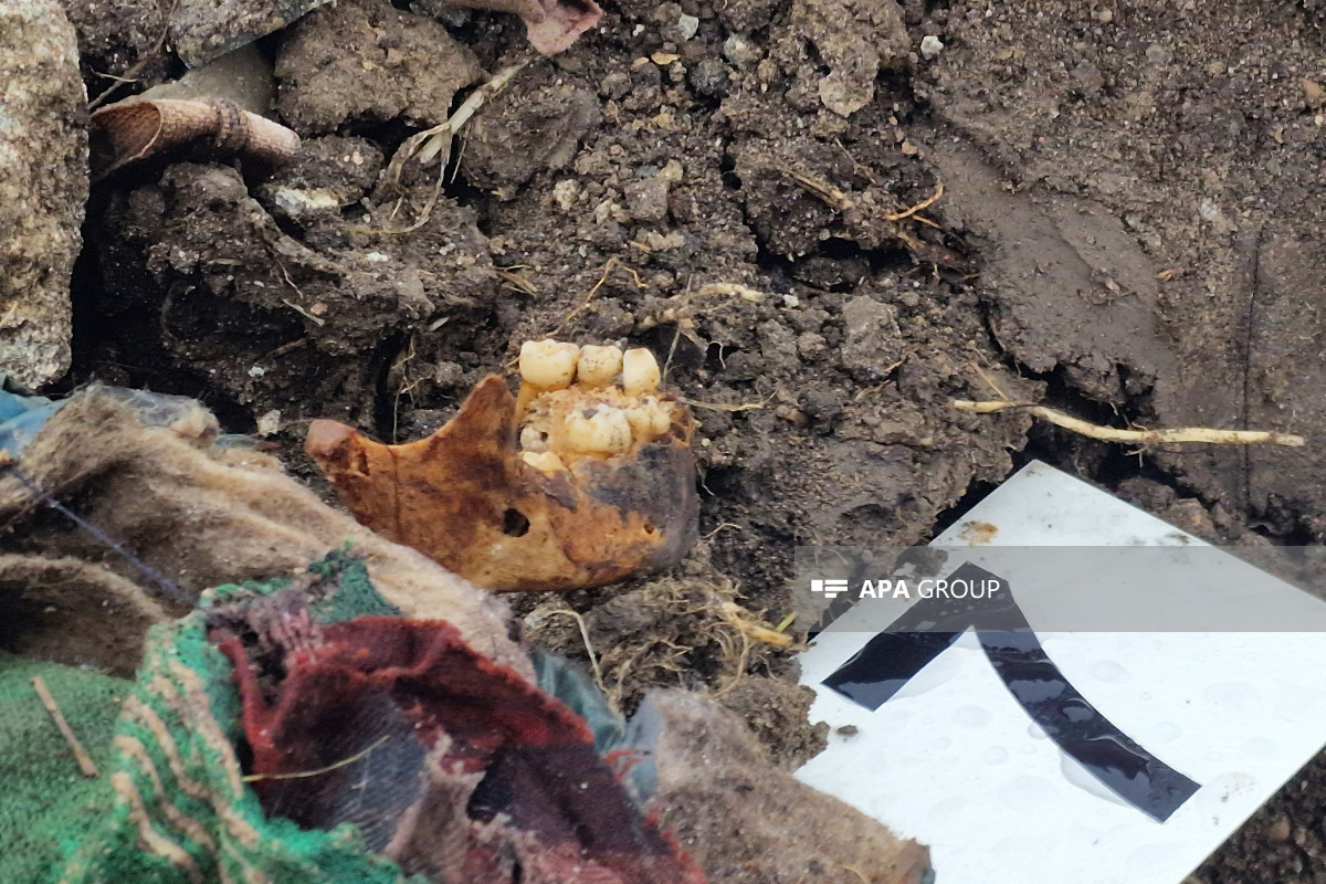 کشف گور دسته جمعی در خوجالی